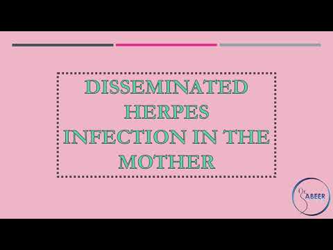 Video: Genital Herpes Suppressiv Behandling Under Graviditet