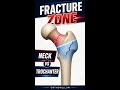 Femoral Neck vs Trochanteric Hip Fractures #Shorts