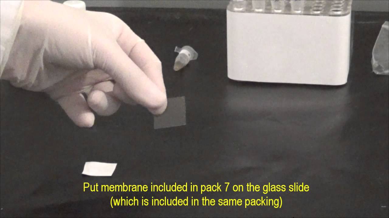 DOT blot Method and Titre Definition (211) YouTube