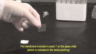 DOT blot Method and Titre Definition (2-11)