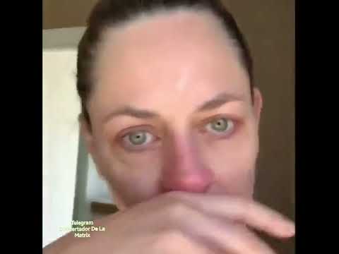 Canadian Actress Jennifer Gibson Suffers Facial Paralysis After the Juice?, Says She?d ?Do It Again