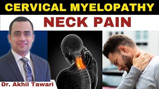 Problem With Neck Spinal Cord | Cervical Myelopathy | Dr Akhil Tawari