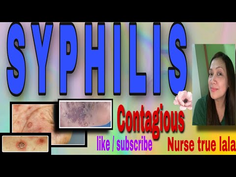 Video: Paano Kilalanin ang Mga Sintomas ng Syphilis (na may Mga Larawan)