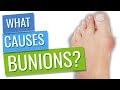Bunions! What Causes Them?