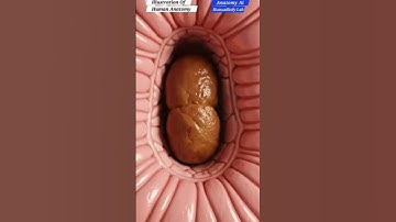 3D Animation of Constipation Explained | Gut Health