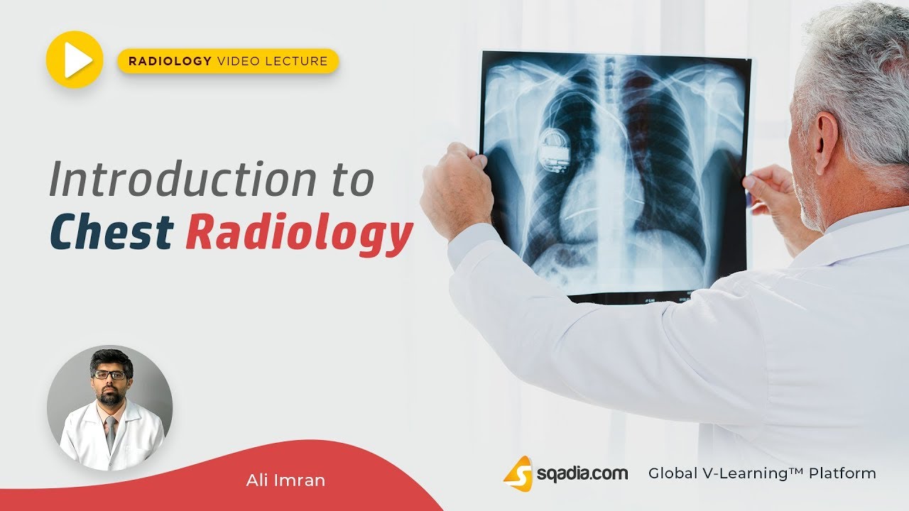 📚 Introduction to Chest Radiology: Essential Online Course for Medical ...
