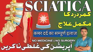 What is Sciatica | Causes, Sign&Symptoms and Its Treatment |Low Back Pain|عرق النسا اور اسکا علاج؟