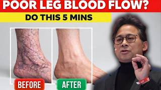 Poor Leg Circulation? 30-Second Test + 3 Fast Fix Exercises/DR .willim li