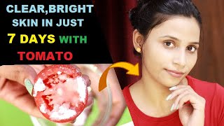 टमाटर ऐसे इस्तेमाल करे निखरी,सुन्दर और बेदाग़ त्वचा के लिए || Tomato for glowing,bright,spotless skin