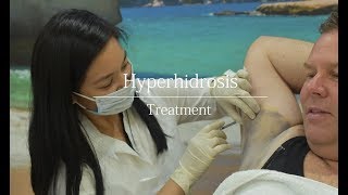 Hyperhidrosis (Excessive Sweating) - Treatment Video for Men