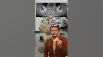 This happens so often 😬 #braces #orthodontics #orthodontist