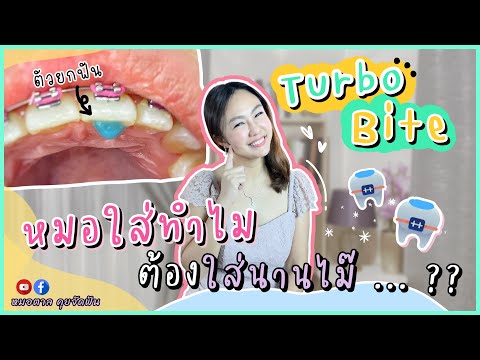 สีดัดฟัน  Update New  Turbobite ยกไบท์จัดฟัน | สีฟ้าๆที่ค้ำฟันคืออะไร? ต้องใส่นานแค่ไหน? 😂 | จัดฟันระยอง