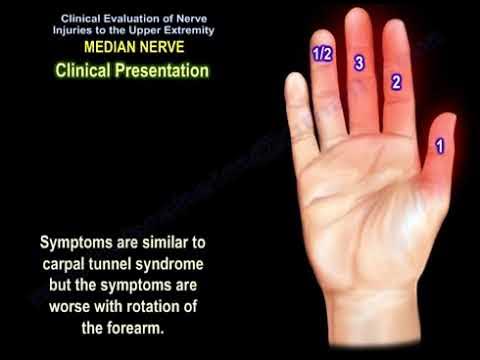 Median nerve injury, causes, symptoms, diagnosis and treatment. Carpal  tunnel syndrome diagnosis. 