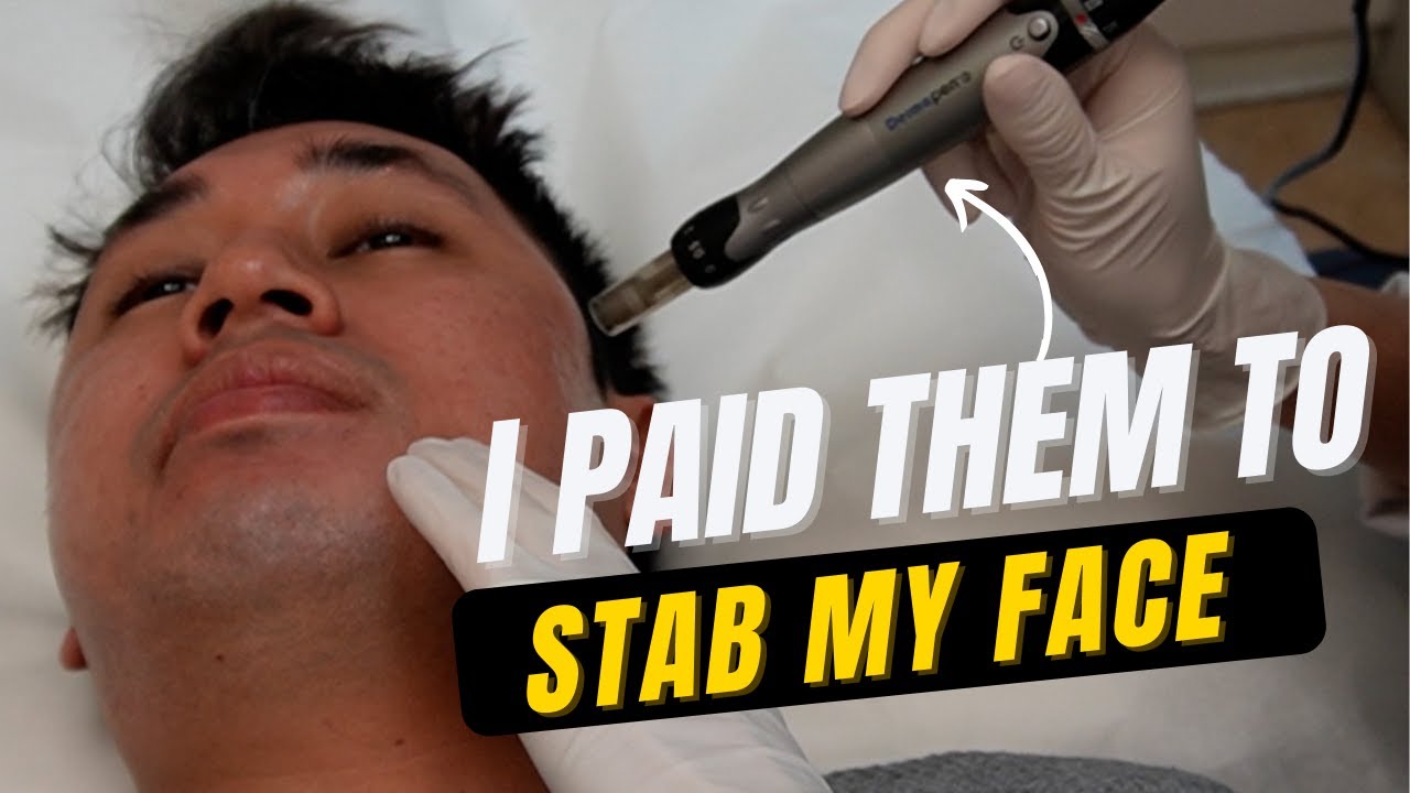 I paid them to STAB my FACE