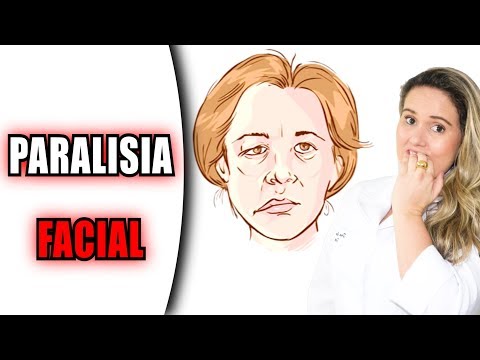 17 Dicas de Exercícios para Paralisia Facial