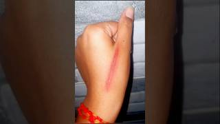 How To Create A Fake Wound