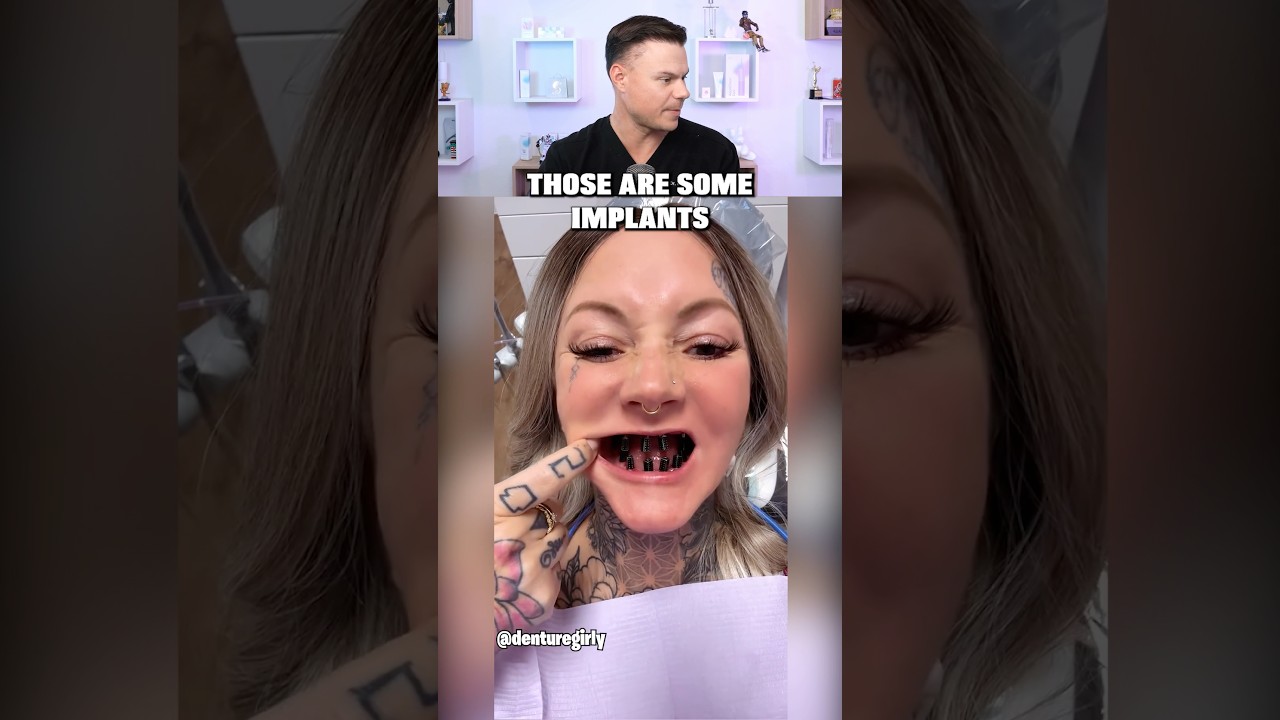 What Happened To Her TEETH?! 😮🦷