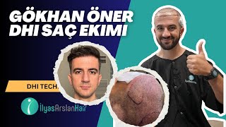 Gökhan Öner Dhi Saç Ekimi Ilyas Arslan Hair Turkiye