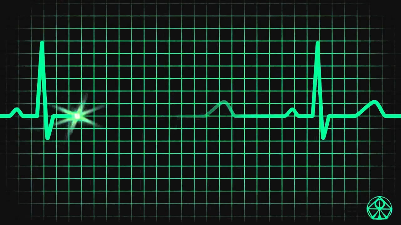 Пульс остановился. Кардиограмма сердца. Остановка сердца на ЭКГ. Пульс. Пульс кардиограмма.