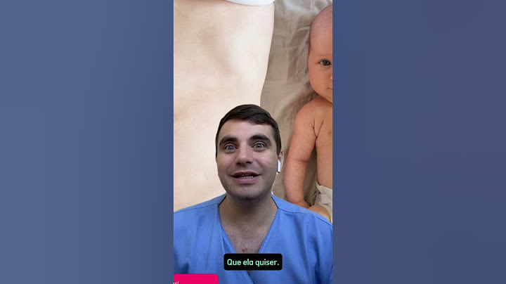 Quanto tempo dura a recuperação da cesariana?