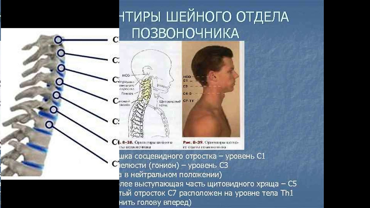 Анатомия шейного отдела позвоночника в картинках