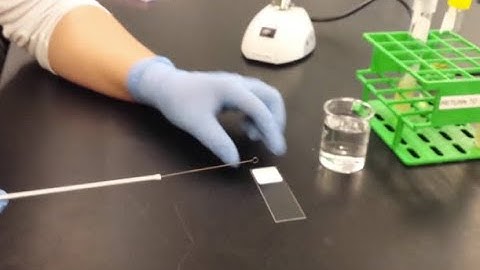 Bacterial smear preparation