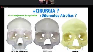 Live: Alternativas para Atrofias  Ósseas Severas  - Prof Dr Vanderlim Branco Camargo
