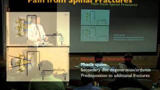 UCSF Radiology: Spinal Fractures and Spinal Disorders