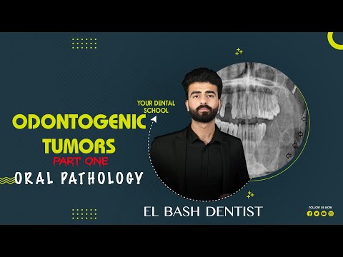 odontogenic tumors | ameloblastoma || part 1 || oral pathology _عزت شومان