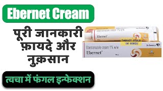 Ebernet Cream Uses In Hindi तवच म फगल इनफकशन Side Effects Dose