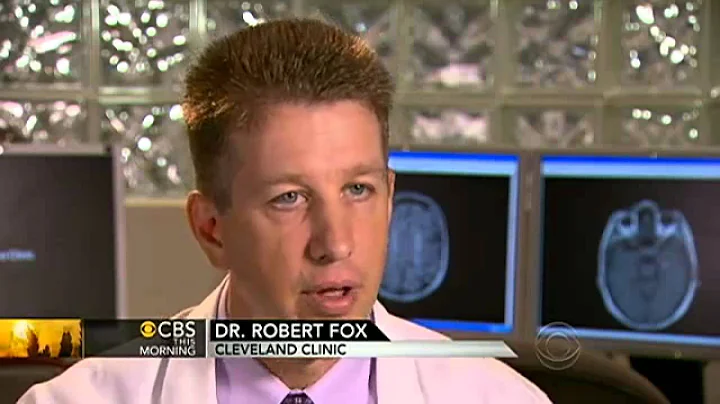 Researchers: New MS drug seems to prevent flare-ups