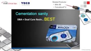 Dr. Griffin on Bifix SE and Futurabond U