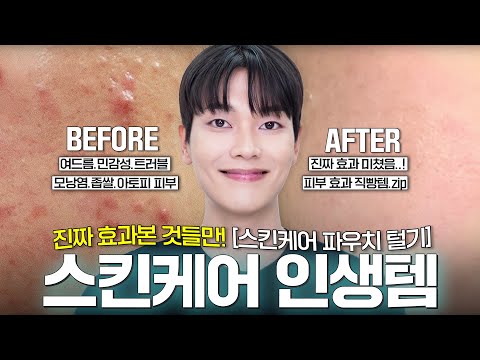 사야할 스킨케어 인생템 20가지🔥여드름/수부지/<strong>좁쌀</strong>/화농성/아토피/지루성피부염 추천템/바르는법/루틴까지~✨[스킨케어 파우치 털기 ep.1]
