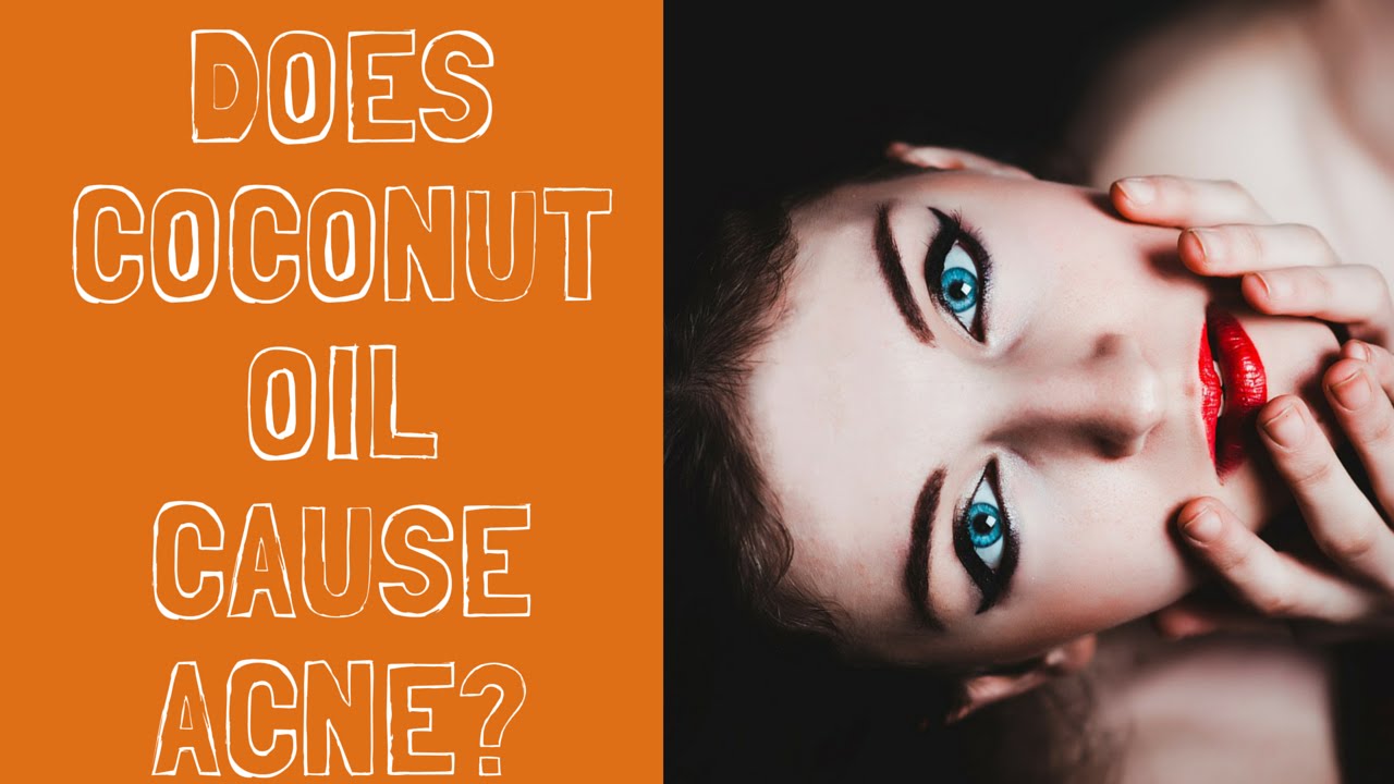 Is Coconut Oil Bad For Acne How to Get Rid of Clogged Pores INSTANTLY