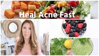 What I Eat To Heal Acne Fast