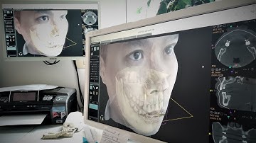 @CarestreamDental #CS9600 HD #Facescan CBCT New Generation