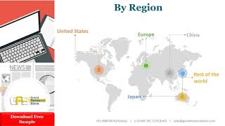 Global Laser Direct Imaging LDI System