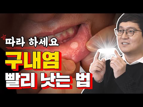 [구내염 치료 꿀팁3] 툭하면 입병 나는 사람~? 이것만 알면 끄-읕