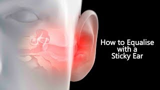 Advanced Frenzel and Mouthfill Tip | How to Equalise with a Sticky Ear
