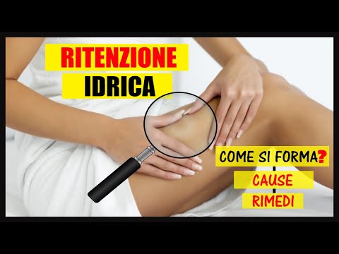 Video: Ritenzione Idrica: Rimedi, Sintomi, Cause E Altro