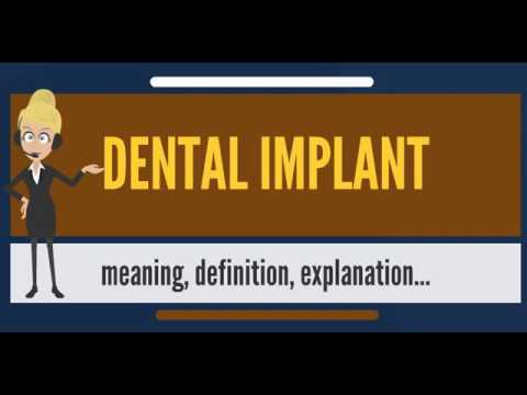 What is DENTAL IMPLANT What does DENTAL IMPLANT mean DENTAL IMPLANT meaning & explanation