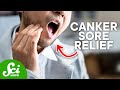 How Do You Get Rid of a Canker Sore?