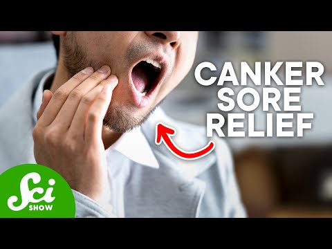 How Do You Get Rid of a Canker Sore?