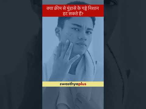 क्या क्रीम से मुंहासे के गड्ढे निशान हट सकते हैं? | Can creams remove Acne Scar? | Dr Aanchal Panth