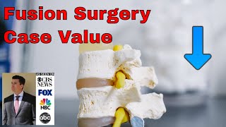Spinal Fusion Surgery Settlement Lawsuit Value after Herniated Disc  What Is My Case Worth Serie
