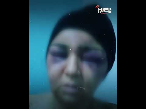 أمينة سيدة طامية بالفيوم جوزها كس ر وشها وبهد ل أعضائها الحساسة والسبب صادم