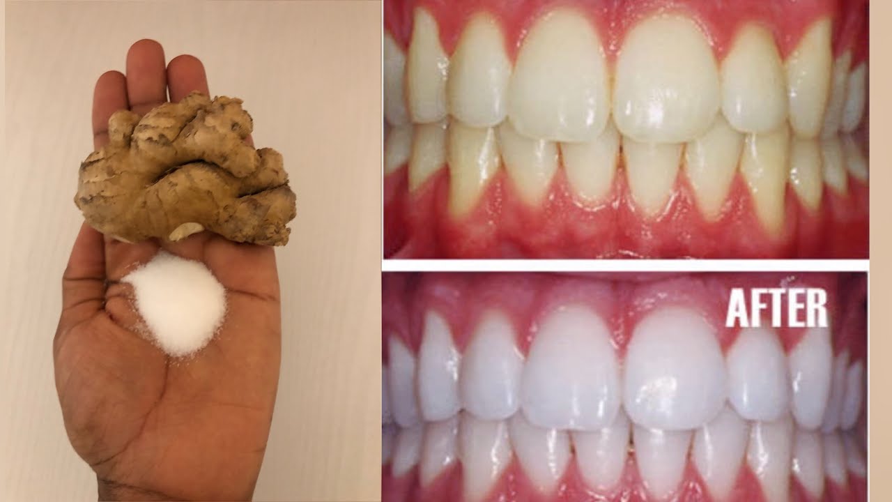 In just two minutes, whiten and shine your teeth like pears ,100