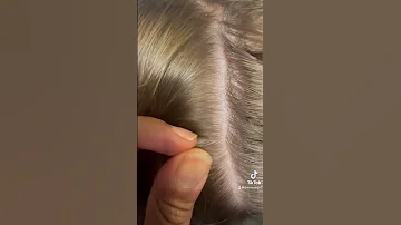 Lice Picking L Tiny Baby Louse L Lice Removal Service Staceythelouselady 