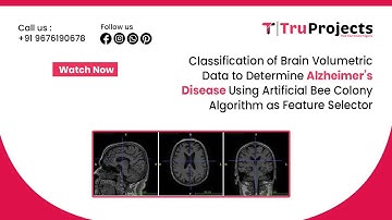 Classification of Brain Volumetric Data to Determine Alzheimer’s Disease Using Artificial Bee Colony