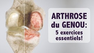 Arthrose du genou: 5 exercices ESSENTIELS